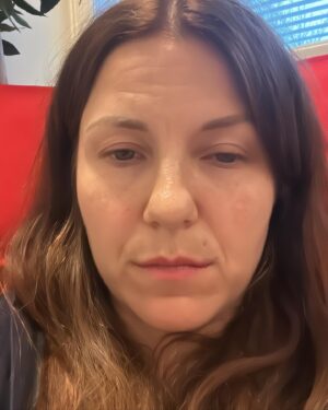 Anna-Liisa Bergström Instagram - Leikkaus ohi🫶🏻
Voin kertoa, että en oo mitään asiaa jännittänyt koskaan noin paljoa. Kaikki oli mulle nimittäin uutta: mun eka leikkaus, nukutus, vahvojen rauhoittavien syönti 🙈😅

Kuva 1. Vartti mun heräämisen jälkeen sain jo valita mitä jätskiä haluan. Mun yhtä lemppari mehujäätä oli tarjolla🩷💛amppari🐝

Kuva 2. Just herännyt ja otin kuvan: olin tosi happy!😍 vihdoin tää sairastelukierre saa jäädä pois

Kuva 3. Oon saanut esilääkityksen ja kattelen puhelinta sekä laitan kavereille videoviestejä ihan pöllyissä🙈😅

Eniten haluan kiittää @pihlajalinnaig upeaa henkilökuntaa. Tunsin olevani hyvissä käsissä ja toinen tärkeä asia on mulle henkilökohtaisesti, että ihmiset on empaattisia ja osaa ottaa tilanteen huomioon. Mää olen aika herkkä tyyppi. Itken ja näytän mun tunteet; ilon ja surun kyyneleet. 
Tähän sain myös ymmärrystä🩷

💛Kiitos Suvi hoitaja, kun otit mut vastaan saavuttuani ja meidän hyvistä keskusteluista

💛Kiitos anestesialääkäri, joka laitoit mulle tipan ja tulit juttelemaan ennen toimenpidettä. Sekä annoit mulle kunnon tropit.
Tipan laittoa jännitin eniten, mutta turhaan. Mun lääkäri oli niin hyvä!!! Tästä mulla oli huono kokemus lapsena, kun olin tutkimuksissa Ouksissa viikon verran migreenin takia.

💛Kiitos mun leikanneelle lääkärille Jussille. Ihanan ihmisläheinen ja mukava. Kävin hänen vastaanotolla aika monta kertaa, kun sitte päätettiin et nyt päästään nielurisoista eroon.

💛Kiitos Hannele, kun olit mun vierellä herätessäni. Olin aivan kuutamolla..mut heti sain jätskiä sänkyyn. Tulit mukaan vessaankin, kun pyysin🙈 oli aika paljon pyörrytystä päässä ja mun verenpaineet kuulemma oli aika alhaiset.

Ja kiitos vielä kaikille muille hoitajille, jotka autoitte leikkaussalissa. Siinä vaiheessa olin jo niin kuutamolla etten muista edes teidän kasvoja🙈🫶🏻

Tästä alkaa mun UUSI JAKSO elämässä puhtaalta pöydältä!
Vihdoin pääsen alottaa kunnolla treenit tän sairastelun jälkeen. Nyt vielä pari viikkoa makoilua, jätskiä ja Maggien kanssa loikoilua sohvalla🐶
@ellugee rakas nyt on ollut mun tukena koko ajan❤️PUS

Nyt otan jo aamun toisen jäden.🍦