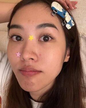 Arikanta Mahapreukpong Instagram - Pimple season