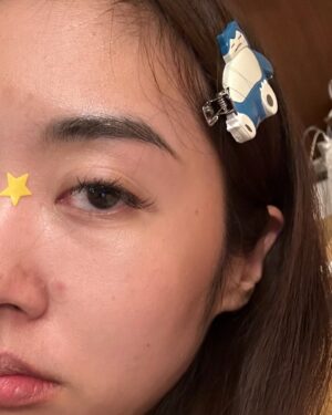 Arikanta Mahapreukpong Instagram - Pimple season