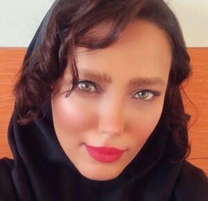 Artemis Pebdani Instagram - RP• @afshinismaeli Hundreds of young Protesters in Iran Blinded by Metal Pellets and Rubber Bullets during Iran protests. 

Security forces have been firing ammunition that has ruptured the eyes of antigovernment demonstrators in the past four months. 

“When you shot me from a two meters distance & smiled, did you think I would survive & answer your smile?!” Says 
Ghazal Ranjkesh
, who lost an eye to pellet bullets during the protests in Iran.

Kowsar Khoshnoodi Kia, a member of Iran’s Women’s National Archery Team who has won medals in national and international competitions. She recently appeared in a video, explaining how she had lost sight in one eye when security forces fired at her.

Since the eruption of the uprising on 16 September 2022, according to human rights organizations Iran’s security forces have killed more than 500 protesters and injured 1000s in a bid to crush the protests.

Pictures: sosial media