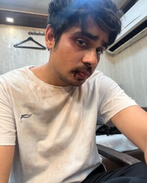 Ashish Verma Instagram - Does drinking blood break your intermittent fasting ?
#intermittentfasting #shootdiaries