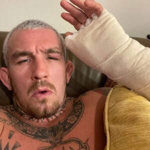 Austin Vanderford Instagram - A little down… but NEVER out! What a beautiful sport. With all the highs, there are also lows. In competition, I understand this. Still thankful for every opportunity to compete 🙏👊🏻. Last Friday wasn’t my night, but this won’t kill my spirit or my plan to be the best. This only motivates me more and makes me realize how much I really love this sport. Because after the worst of the worst, all I want is to be right back in the gym, working to improve. Little 6 week break from surgery on my broken hand from the fight, and I’ll be back!