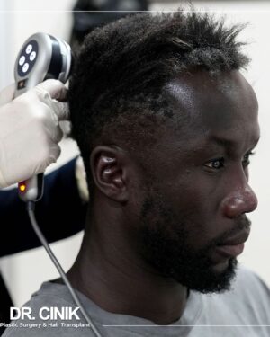 Bacary Sagna Instagram - @dr.cinikhospital effect ✨ Through years having dreadlocks, my scalp was obviously damaged. Didn’t know what to expect but i was pleased to see the result the next day.. No pain, No bleeding.. @dr.emrahcinik you’ve been named man of the match ✨🙏🏿😏