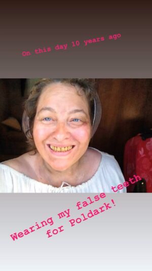 Beatie Edney Instagram - Wearing false teeth 10 years ago for my character Prudie in Poldark. #BTS #poldark #actorslife