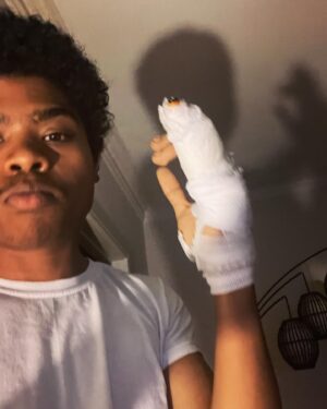 Benjamin Flores Jr. Instagram - A homemade splint