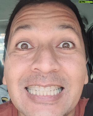 Carlos Solano Instagram - Me puse brackets, soy adolescente 😁
@clinicadualdental