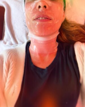 Carly Pope Instagram - Pre/During/Post

“What does my Friday need,” I mused.

Def a trip to @sagelaneskincare for a #microneelding treatment to get my face that perfect shade of “coy red” for the weekend 

Molly, you’re the best. Extra cuddles courtesy of Willie.

Come at me collagen 🫡 ♥️ #notox