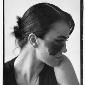 Cassandra Naud Instagram - Just a girl and her birthmark. Happy birthmark awareness month 🖤

On film by Jack Perry 🎞️