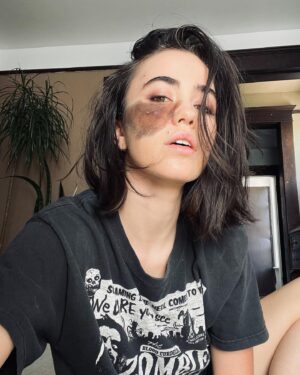 Cassandra Naud Instagram - I burned my own leg with steamer 2 days ago. For context I was steaming pants that had on and I was feeling really confident. The steamer won this round. But I’ll be back. #lessonnotlearned