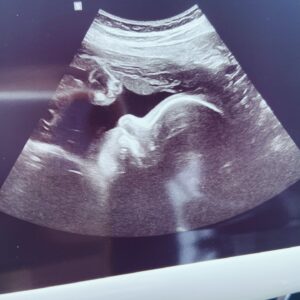 Cory Lee Instagram - Your new life will cost you your old one 💯

The last 30 days have been a rollercoaster to say the least! From the hardest move I think I will ever do to my dream maternity shoot we are doing our best to settle into our new house and get ready for baby ❤️🏡🍼