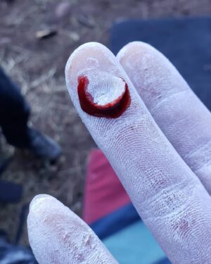 Daniel Woods Instagram - There will be blood

price u gotta pay sometimes in order to send. I mostly complain about my finger skin while climbing. The condition of it will truly make or break my confidence while trying hard. Such a small yet devastating injury 😂