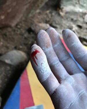 Daniel Woods Instagram - There will be blood

price u gotta pay sometimes in order to send. I mostly complain about my finger skin while climbing. The condition of it will truly make or break my confidence while trying hard. Such a small yet devastating injury 😂