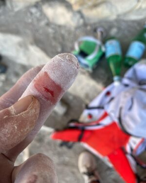 Daniel Woods Instagram - There will be blood

price u gotta pay sometimes in order to send. I mostly complain about my finger skin while climbing. The condition of it will truly make or break my confidence while trying hard. Such a small yet devastating injury 😂
