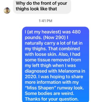 Darienne Lake Instagram - We don’t always get to walk in each others shoes. Let’s have teachable moments to understand each other. The only offense I take, is if they don’t learn and move forward with empathy and kindness. This is why my “Miss Shapen” runway was so important to me. Some of us are broken, but beautiful.