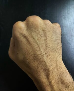 Dave Leduc Instagram - King knuckle 👑 Is my hand normal? 😂 that’s my knuckle after years of fighting bareknuckle 👊

ကျွန်တော့်လက်ကပုံမှန်ဟုတ်ရဲ့လားဗျာ 😂 နှစ်နှင့်ချည် လက်ဗလာ နှင့်ထိုးခဲ့တဲ့ ကျွန်တော့် ရဲ့ လက်သီး။ – ဒေဝ

តើដៃរបស់ខ្ញុំធម្មតាទេ? 😂 នោះជាកណ្ដាប់ដៃរបស់ខ្ញុំ បន្ទាប់ពីប្រយុទ្ធគ្នាអស់ជាច្រើនឆ្នាំ – ដាវ