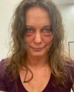 Deanna Russo Instagram - I love love love SFX makeup so I was thrilled to be the sick person du jour on #greysanatomy Bonus joy for getting to say the best line on national television ever 🥰