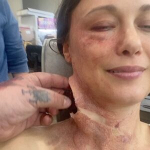 Deanna Russo Instagram - I love love love SFX makeup so I was thrilled to be the sick person du jour on #greysanatomy Bonus joy for getting to say the best line on national television ever 🥰