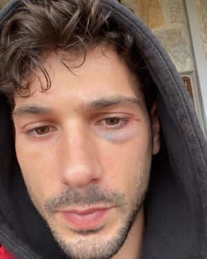 Deniz Can Aktaş Instagram - 