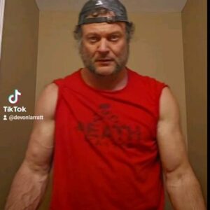 Devon Larratt Instagram - 20 months post @levansaginashvili 
Healing up well. Thanks @vitacellbiologics