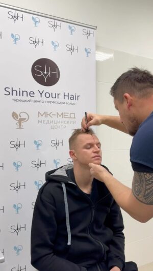 Dmitry Tarasov Instagram - ОПЕРАЦИЯ ПРОШЛА УСПЕШНО! 🔥

Доверился моим друзьям @shineyourhair.spb 💇🏼‍♂️ Операция по пересадке волос прошла успешно! Быстро, а главное качественно! 🔥