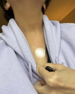 Dolly de Leon Instagram - A patch a day keeps the doctor away.😎

Been using @lifewave.philippines Y-age Glutathione for 6 months now and I’ve never gotten sick. Swear! It supports the immune system, improves skin health and cellular function. 

Thank you, @engrjeffsantos and @msderossi sa revelation na ito!