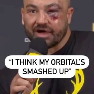 Eddie Alvarez Instagram - Eddie Alvarez got a lesson in the “volatile” nature of BKFC vs. Mike Perry 🤕 #BKFC56