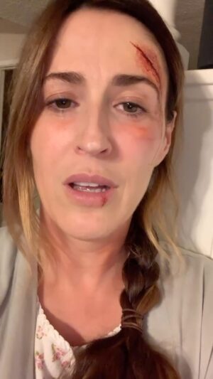 Elle Newlands Instagram - never one to waste good SFX makeup on set 😅 …. seriously, beware the LA avocado toast crowd though 🔪 🥑(EDIT : to the kind people messaging who are worried, this is just very good makeup. No avocados or Scottish people were harmed in the making of this PSA, I promise ❤️)