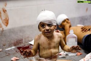 Ertuğrul Postoğlu Instagram - Bu Katliamı durdurun… Hastane bombalamak çocukları öldürmek bir İnsanlık Suçudur.. #savaşahayır #gazzedekatliamvar