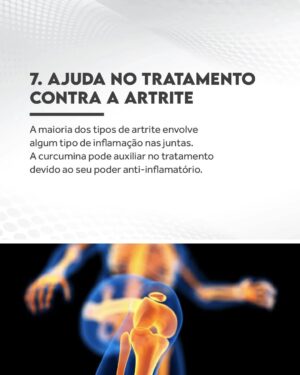 Flavio Passos Instagram - Quero te contar mais sobre a cúrcuma, raiz da família do gengibre que é possivelmente uma das substâncias da natureza mais benéficas para a saúde humana.

É a especiaria de vibrante tonalidade amarelo-dourada que dá ao curry sua cor e tem sido utilizada há milênios na Ayurveda, tradicional medicina indiana, como fonte de saúde e bem-estar. Seus compostos são chamados de curcuminoides, dentre os quais o mais importante é a curcumina. 

A ciência moderna destaca a curcumina como um dos mais nobres compostos naturais, uma dádiva com mais de 5.600 estudos científicos publicados para detalhar suas diversas propriedades saudáveis. 

Deslize para o lado e conheça nove dos diversos benefícios que a cúrcuma pode trazer à saúde.

Acesse puravida.com.br e conheça nossa linha de produtos com cúrcuma e curcumina biodisponível. Compre pelo site e receba em casa!

Estudos:
https://pubmed.ncbi.nlm.nih.gov/31121255/
https://pubmed.ncbi.nlm.nih.gov/27533649/
https://www.ncbi.nlm.nih.gov/pmc/articles/PMC7694612/
