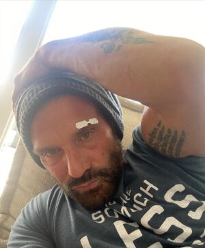 Frank Grillo Instagram - #tbt. To twenty minutes ago. Sometimes we tangle w the wrong person .... or sliding glass door. Yeah. I walked into my door. #butterflystitch #beatenbythedoor.  #scar. 😂🥊😖