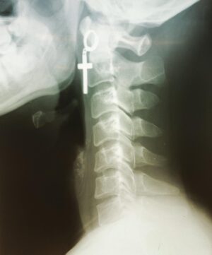 Fukase Instagram - text neck

ストレートネック