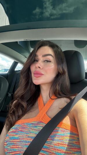 Gabrielle Marion Instagram - The end of an era 👄👋🏼 
J’ai envie de prendre une direction plus « naturelle » mais un pas à la fois. Je vieillis et j’avais l’impression que mon image ne me représentait plus autant. 👵🏼

Ça fait des années que j’accumule des fillers dans mes lèvres et, avec le temps, le corps finit par ne plus les absorber. J’avais l’impression qu’au contraire, mes lèvres continuaient de prendre de l’expansion. J’ai donc décidé de réduire ma lèvre supérieure grâce à l’enzyme appelée « hyaluronidase », qui est à base de venin d’abeille. La douleur est insoutenable, mais c’est pour une bonne cause.

Je conseille à tout le monde de dissoudre l’accumulation d’agents de comblement pour au moins revenir à la base, quitte à repartir à zéro. ✨ Mon nouveau meilleur ami: le lip liner 👏🏼

#dissolvingfiller #lipdissolve #fillers