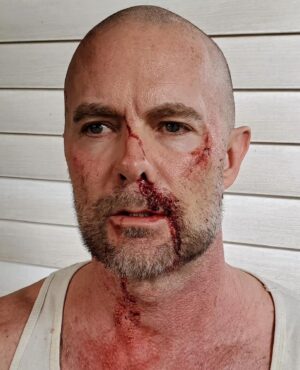 Garret Dillahunt Instagram - Here’s some non-prosthetic beat-down trauma by @trevorthompsonmakeup for #RRH.  Great work, Trevor.  Much less painful than actually taking a hit from @thekennymiller.