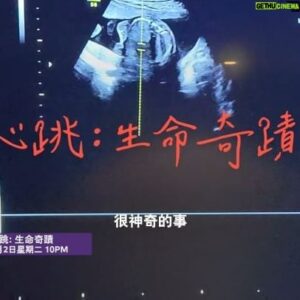 George Young Instagram - Happy World IVF Day! 【世界試管嬰兒日】快樂！ Let’s make babies!

1978年7月25日世界第一個試管嬰兒誕生，人類第一次以體外受精(IVF) 方式孕育下一代，自此開始，每年有數百萬嬰兒透過IVF方式來到這個世界，也讓無數無法自然懷孕的夫婦獲得重生。
On July 25, 1978, the world’s first IVF baby was born. Now, millions of children are born with the help of in vitro fertilization (IVF) every year. 

八月二日，George 與我將與大家分享這五年來的 IVF 歷程，從卵子與精子的冷凍、流產、體外受精療程到懷孕生產，這些充滿挫折卻也充滿希望的過程，我們將為大家娓娓道來，我們希望能藉此告訴與我們有著相同問題的人 – 你並不孤單。
On August 2, George and I share our 5-year journey of egg and sperm freezing, miscarriage and IVF treatment. You are not alone. 

#ourstory #comingsoon #worldIVFday #Discovery #TLC #旅遊生活頻道 #trailer
【世界試管嬰兒日】快樂！