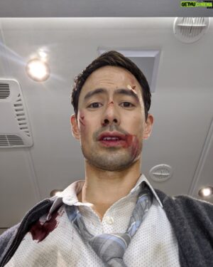 George Young Instagram - #Malignant Stories: Blood, Sweat and Tears:

...all went into making this movie as visceral an experience as possible- some real (pics 3 4 for some real little cuts bruises from the shoot), some fake (pic 1, and pic 2 shows how it's done).

Actually make that a LOT of fake blood (as you the audience can attest to).

Good times and so happy to hear you're all enjoying the show!