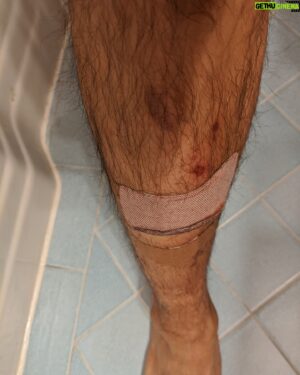 George Young Instagram - #Malignant Stories: Blood, Sweat and Tears:

...all went into making this movie as visceral an experience as possible- some real (pics 3 4 for some real little cuts bruises from the shoot), some fake (pic 1, and pic 2 shows how it's done).

Actually make that a LOT of fake blood (as you the audience can attest to).

Good times and so happy to hear you're all enjoying the show!