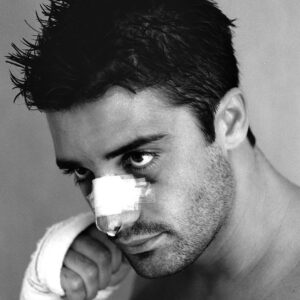 Gilles Marini Instagram - #TBT… Real broken nose, 1 week post surgery. Perfect timing to shoot some “look I’m so tough” 🤣🤣🤣 
Love you all. ❤️ Happy Thursday!