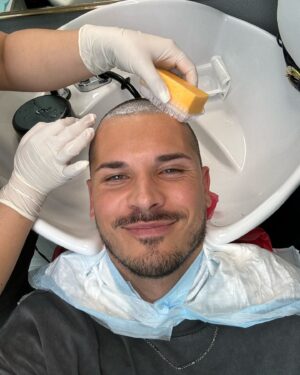 Gleb Savchenko Instagram - I am absolutely thrilled with the incredible care and expertise from Dr. Mohebi and his phenomenal team at @parsamohebihairrestoration! 🌟 I feel beyond grateful for their skill, kindness, and dedication, which made my hair transplant experience comfortable and reassuring. 

I’ve been contemplating this step for years, especially as my hair started thinning during Covid, and now I couldn’t be happier with my decision.

The attention to detail and the precision they demonstrated, particularly during the hair wash, has been truly remarkable. It’s been six days since my surgery, and I’m recovering wonderfully. Now, I’m so excited and optimistic about the amazing results ahead! Swipe to see some pics, including today’s hair wash 🧼😁