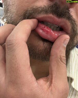 Gustavo Egelhaaf Instagram - DUMP 💥