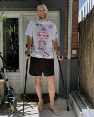 Gustavo Hofman Instagram - A primeira semana já foi! Há exatos sete dias fiz a cirurgia de reconstrução do ligamento cruzado anterior do meu joelho esquerdo, além da sutura do menisco, aqui em Madri. Só posso agradecer a @amal_azzam_lopez pela indicação do doutor Primitivo Gómez Cardero. Os primeiros dias são realmente horríveis, não há como descrever de outra maneira. Para dormir é uma merda. Felizmente a evolução está indo muito bem; as dores estão diminuindo e a cada dia me sinto melhor. Sigo ainda com os analgésicos e os antiinflamatórios, muito gelo todos os dias e exercícios isométricos realizados em casa, para evitar ao máximo a perda de massa muscular e recuperar a amplitude de movimento do joelho. A sutura no menisco é bem chata porque demanda um longo período sem apoiar a perna no chão. Estou ansioso pela consulta de retorno para ser liberado e iniciar a fisioterapia pra valer. De qualquer modo, minhas sensações são muito boas. O mais importante nesse processo é ter consciência de quão duro e longo ele é. Paciência e resiliência são fundamentais. E esposa e filhos como tenho, que ajudam em tudo e permitem essa recuperação plena ❤️ @vivianetella. Seguimos!