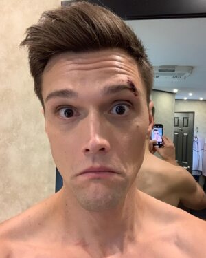 Hartley Sawyer Instagram - Got this lil’ shiner on episode six... @dpanabaker worked me hard 😂 can’t wait for you all to see it this coming Tuesday! @cwtheflash #theflash