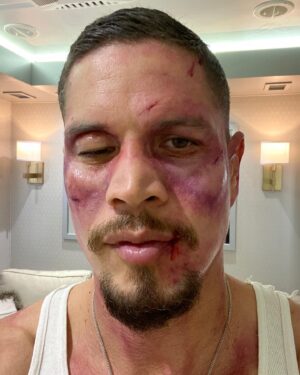 J. D. Pardo Instagram - You should see the other guy 💪🏼 #mayansmc #specialeffects