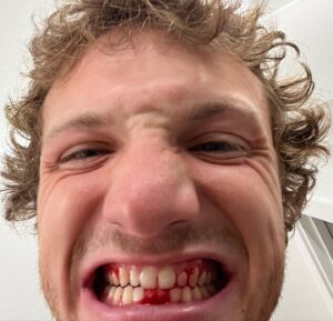Jake Short Instagram - 2022 will be known as the year of the chameleon