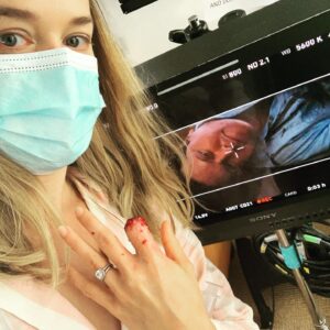 Jess Weixler Instagram - You should see the other guy #pullmyfinger 🐒💨 #tistheseason @michaelmosley @ladygallows (finger effects)