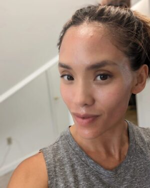 Jessalyn Wanlim Instagram - No filters and going on 41! Thank you @toyosclinicaesthetics for round 2 of #mixtolaser resurfacing treatment. I've gotten so many compliments on my skin and now we're just working on some stubborn acne scars 🤍
1. 15 minutes after treatment (and barely any redness at that!)
2. Waiting for numbing cream to do its work
3. Immediately after my mixto session
4. Dr. Melissa did my hands too since I have massive insecurities there🙈
.
.
.
.
#antiaging #laserresurfacing #nashville #medspa #laserresurfacingtreatment #mixto