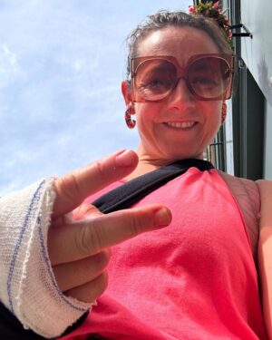 Jessica Fostekew Instagram - ⚠️ this post contains a gross x-ray of my snapped arm bones 🩻 ⚠️

I won’t be posting any 🏋🏻‍♀️ for a while 😢 

On Sunday I broke the fuck out of my wrist and arm trying to learn a new gymnastic movement called a pull-over. KIDS: DON’T USE GRIPS FOR PULLOVERS PLZ. My body went over but my hands didn’t 🤮 

It was bad bad. I’m a twit for using grips for that movement but it was new and I just didn’t have a clue. Ugh. 

A man called Hugh at my gym is a guardian angel. He took me to hospital and stayed with me all day and evening then collected my car 🦸🏻‍♂️❤️

Big shout out to amazing @lg_nhs for taking incredible emergency care of me. On Tuesday I had surgery with a plate, pins AND a wire whacked in there 🦾

I’ve had so many kind kind things from friends I’m touched as absolute fuck 💐 

I’m 💔 to have lost an exciting acting job I had coming up (fairly, my character would have needed to have a broken arm for ten years 😂). But I’m already back to work in every other respect ✌🏻

Also left-only-handed lyf is ON. I’ve learnt left handed writing, injecting my own tummy with one hand and today I chopped up a BUTTERNUT SQUASH. I WILL NOT BE DEFEATED.

And my beloved PE. I’m gonna get such a fucking massive left arm and become the fastest bastard on a static 🚲 you’ve ever met. 

I’ll also have loads of therapy, naturally. 

Onwaaaaaaaaards (really fucking slowly)