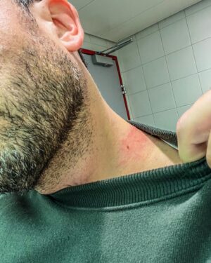 João Paulo Rodrigues Instagram - Ossos do ofício de voar invertido e às cambalhotas! Meus ricos cintos!!! 😜🫣
#aerobatics #pilotlife #acrobaticpilot