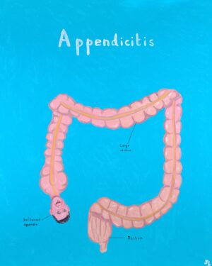 Joe Lycett Instagram - On this special day I’m pleased to reveal this painting I did for my upcoming book called ‘Appendicitis’, a condition where a useless organ becomes inflamed due to a huge build up of toxic bacteria, which if left untreated ultimately destroys the organ and eventually everything around it.

Entirely unrelated: the result of the North East Somerset seat, currently held by Jacob Rees-Mogg, is expected around 4:30am on 5th July, which just so happens to be my birthday.

VOTE 🗳️