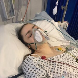 Julia Carlile Instagram - 1 year post op. Then > current day in chronological order. Swipe to the end to see my progress🙌🏻
