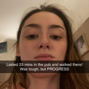 Julia Carlile Instagram - 1 year post op. Then > current day in chronological order. Swipe to the end to see my progress🙌🏻